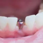 Business 3 image ACTON DENTIST ROXDENTAL Orthodontists in London Gr