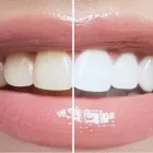 Business 4 image ACTON DENTIST ROXDENTAL Orthodontists in London Gr