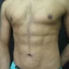 Business 1 image ADVANCED LIPO CENTRE Plastic & Cosmetic Surgery in Hove Ea