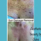 Business 1 image AESTHETIC BEAUTY BY JULES Skin Care Clinics in Kenilworth Wa