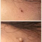 Business 9 image AESTHETIC BEAUTY BY JULES Skin Care Clinics in Kenilworth Wa