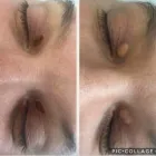 Business 10 image AESTHETIC BEAUTY BY JULES Skin Care Clinics in Kenilworth Wa