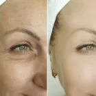 Business 2 image ALLURE MEDISPA LIVERPOOL Cosmetic Surgery in Liverpool Me