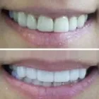 Business 4 image ASPIRE LASER CLINICS Medical Facilities in Leeds We