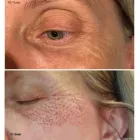 Business 10 image BEAUTIFUL BROWS BY RACHEL Tattoo Artists in Plymouth De