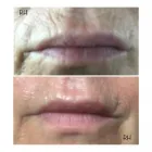 Business 11 image BEAUTIFUL BROWS BY RACHEL Tattoo Artists in Plymouth De