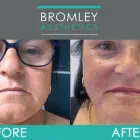 Business 2 image BROMLEY AESTHETICS LTD Dermal Filler Treatment in Orpington Ke