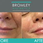 Business 4 image BROMLEY AESTHETICS LTD Dermal Filler Treatment in Orpington Ke