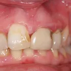 Business 7 image CHRIS BOUGH CARAVANS Caravan Repairs & Service in Newcastle Upon Tyne Ty