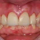 Business 1 image CHRIS BOUGH CARAVANS Caravan Repairs & Service in Newcastle Upon Tyne Ty