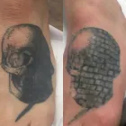 Business 3 image CLEARSKIN Tattoo Removal Service in Newcastle Upon Tyne Ty