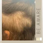 Business 15 image CRLABS LTD Wigs & Hairpieces in Liverpool Me