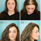 Business 26 image CRLABS LTD Wigs & Hairpieces in Liverpool Me