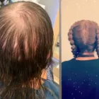 Business 27 image CRLABS LTD Wigs & Hairpieces in Liverpool Me