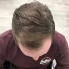 Business 1 image ESTE HAIR MEDICAL LONDON Hair Removal in Harrow Gr