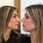 Business 4 image ESTE HAIR MEDICAL LONDON Hair Removal in Harrow Gr