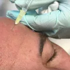 Business 5 image GRADE 1 BARBERS Skin Care Clinics in OTLEY We