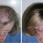 Business 5 image HAIR LOSS LIVERPOOL Wigs & Hairpieces in Liverpool Me