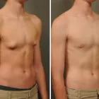 Business 6 image HARLEY STREET COSMETIC SURGERY PARTNERS Plastic & Cosmetic Surgery in London Gr