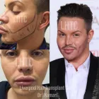 Business 2 image LIVERPOOL HAIR TRANSPLANT CLINIC Health & Medicine in Liverpool Me