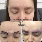 Business 3 image LIVERPOOL HAIR TRANSPLANT CLINIC Health & Medicine in Liverpool Me