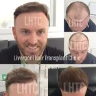 Business 4 image LIVERPOOL HAIR TRANSPLANT CLINIC Health & Medicine in Liverpool Me