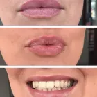 Business 2 image MEZMARIEEYES Tattoo Removal Service in Nuneaton Wa