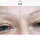 Business 4 image MEZMARIEEYES Tattoo Removal Service in Nuneaton Wa