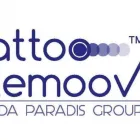 Business 5 image MEZMARIEEYES Tattoo Removal Service in Nuneaton Wa