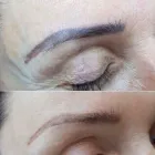 Business 6 image MEZMARIEEYES Tattoo Removal Service in Nuneaton Wa