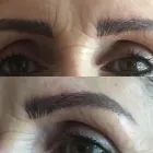 Business 8 image MEZMARIEEYES Tattoo Removal Service in Nuneaton Wa