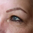 Business 12 image MEZMARIEEYES Tattoo Removal Service in Nuneaton Wa