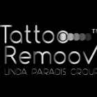 Business 13 image MEZMARIEEYES Tattoo Removal Service in Nuneaton Wa