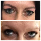 Business 14 image MEZMARIEEYES Tattoo Removal Service in Nuneaton Wa