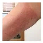 Business 1 image PLASMAPOD Skin Care Clinics in Brighton Ea