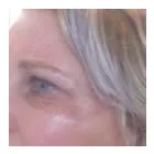 Business 4 image PLASMAPOD Skin Care Clinics in Brighton Ea