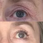 Business 6 image PLASMAPOD Skin Care Clinics in Brighton Ea