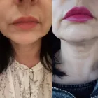 Business 7 image PLASMAPOD Skin Care Clinics in Brighton Ea