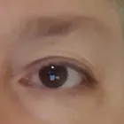 Business 8 image PLASMAPOD Skin Care Clinics in Brighton Ea