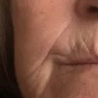 Business 10 image PLASMAPOD Skin Care Clinics in Brighton Ea