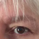 Business 11 image PLASMAPOD Skin Care Clinics in Brighton Ea