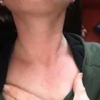 Business 12 image PLASMAPOD Skin Care Clinics in Brighton Ea