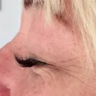 Business 13 image PLASMAPOD Skin Care Clinics in Brighton Ea