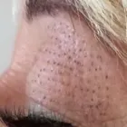 Business 15 image PLASMAPOD Skin Care Clinics in Brighton Ea