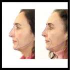 Business 10 image THE CENTRE FOR ADVANCED FACIAL COSMETIC AND PLASTIC SURGERY: DR JULIAN DE SILVA Cosmetic Surgery in London Gr