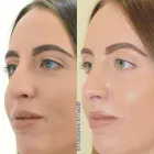 Business 11 image THE CENTRE FOR ADVANCED FACIAL COSMETIC AND PLASTIC SURGERY: DR JULIAN DE SILVA Cosmetic Surgery in London Gr