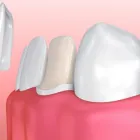 Business 1 image THE TOOTH SPA Dentists in Leeds We