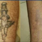 Business 2 image VELVET TATTOO REMOVAL Tattoo Removal in Brighton Ea