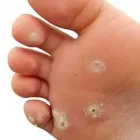 Business 4 image WE FIX FEET Medical Facilities in Ilkeston De