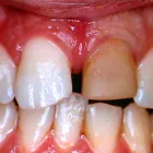 Business 4 image WHITESTAR DENTAL PRACTICE Dentists in Harrow Mi